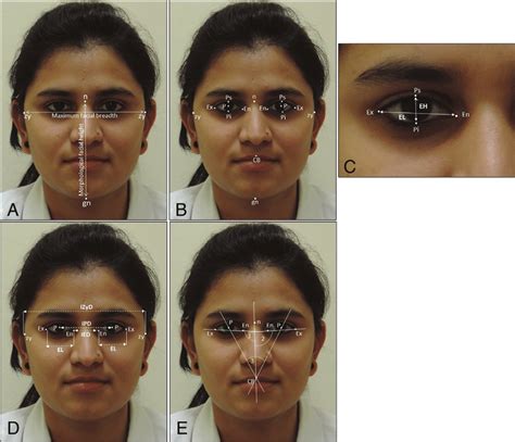 A Evaluation Of Facial Index Fi As Suggested By Martin And Saller Download Scientific