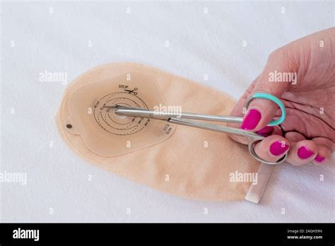 Top View On Ostomy Bag And Scissors In Female Hand On White Background