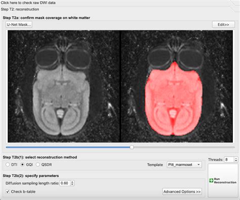 Dwi Marmoset Brain Connectivity Brain Minds