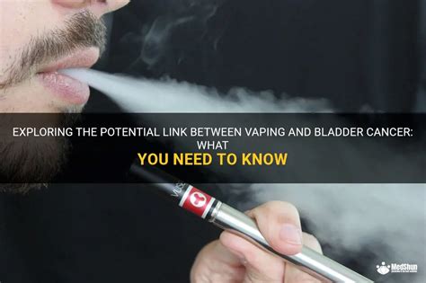 Exploring The Potential Link Between Vaping And Bladder Cancer What