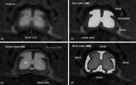 Spinal Cord Mr Of Rodent Models Radiology Key