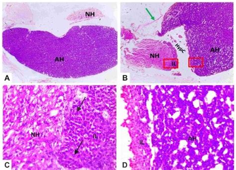 The Photomicrographs Of Pituitary Gland Of The Gcr A The Gland