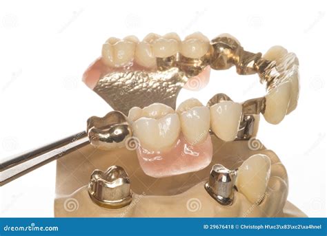 Isolated Denture On A White Background Dental Prosthesis Care Full