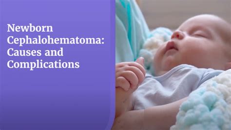 Newborn Cephalohematoma Causes Symptoms Treatment