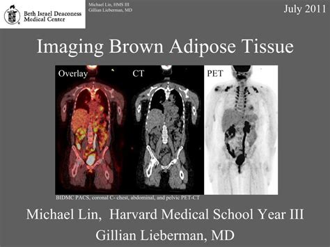 Pdf Imaging Brown Adipose Tissue Dokumentips