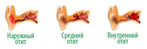 У малыша болит ухо: как и чем лечить дома, первая помощь. Отит у ...