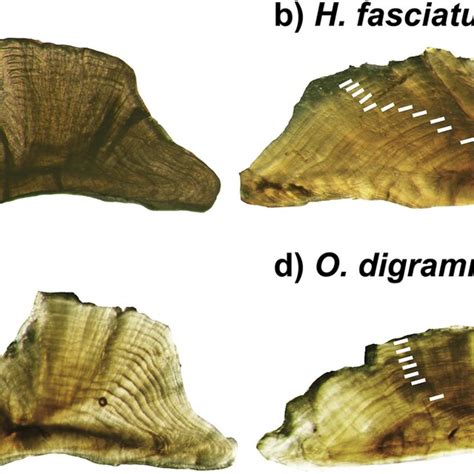 Transverse Sections Of Sagittal Otoliths Displaying Putative Annual