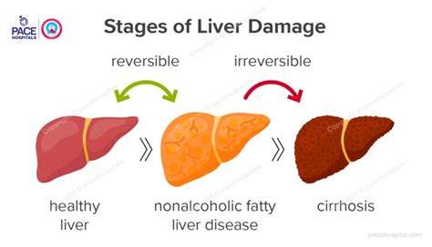 Non alcoholic fatty liver disease (NAFLD) - Causes and Symptoms