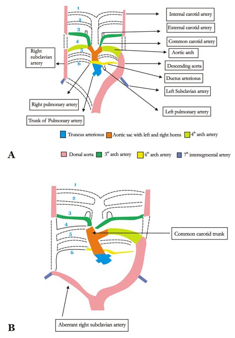 Causes Subclavian Steal Syndrome