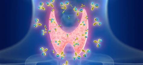 Antikörper bei Hashimoto Thyreoiditis Symptome Ursachen und