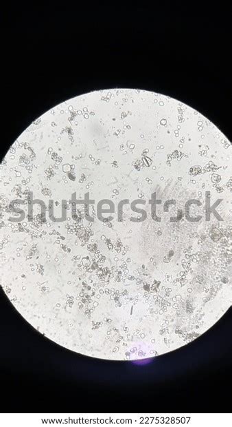 Uric Acid Crystals Amorphous Urine Ph Stock Photo 2275328507 | Shutterstock