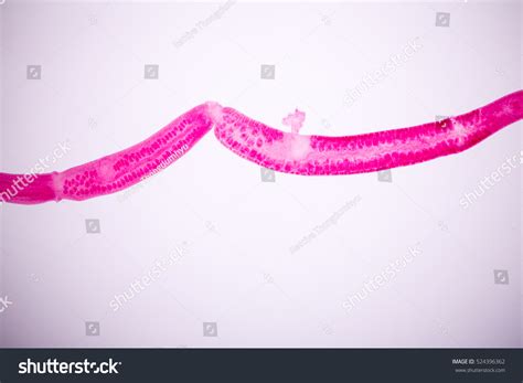 Parasite Under Microscope Stock Photo (Edit Now) 524396362