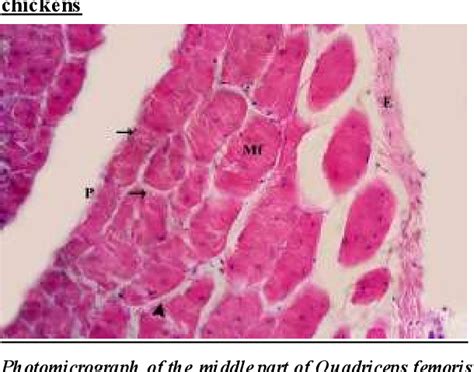 PDF Histological Properties Of Intramuscular Connective Tissues In