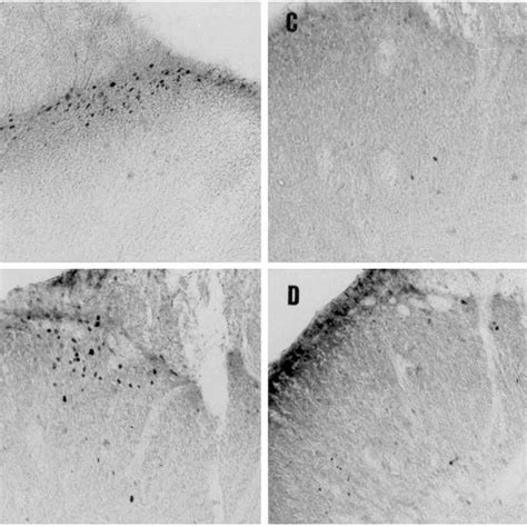 Photomicrographs Illustrating The Expression Of Fos Like Immunoreactive