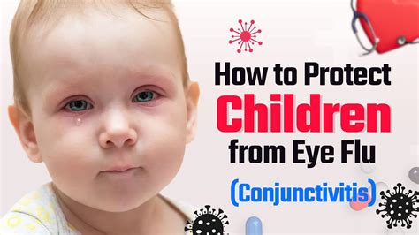 How to protect Children from Eye Flu बचच म ऑय फल कस ठक कर