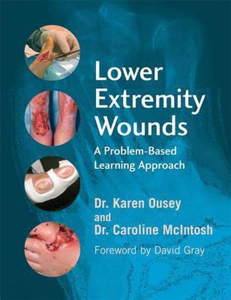 Lower Extremity Wounds 9780470059081 Ousey Boeken