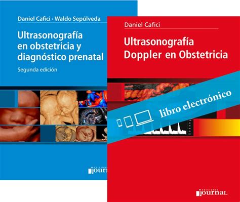 Ultrasonografia Doppler En Obstetricia Medilibro