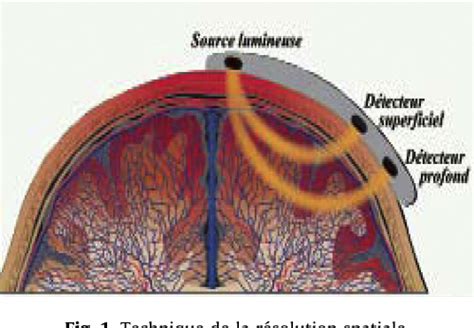 Figure From Cerebral Near Infrared Spectroscopy Nirs In Paediatric