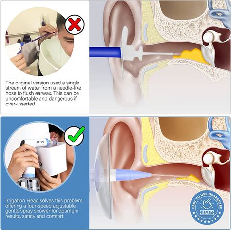 Earwax Removal Electric Irrigation Cleaner Earwax Rinse Cleaning Ear Kit Ear Wax Washer Lavage