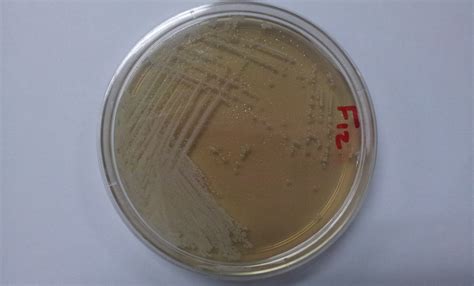 White Colonies On Chromagar Candida Researchgate