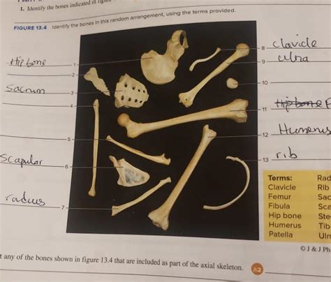 Solved Identify The Bones Indicated In Figure Chegg