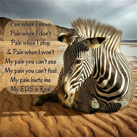 Ehlers Danlos | Ehlers-Danlos Syndrome | Pinterest