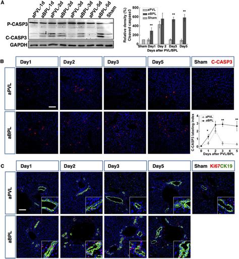 BPL Resulted In More Intense Hepatocyte Apoptosis And More Evident