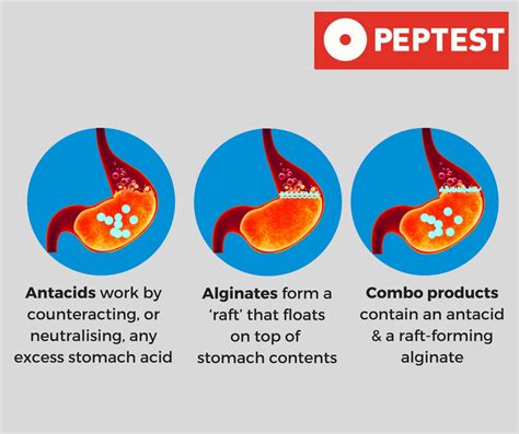 Alginate Antacids For Treating Reflux A Medication Comparison Study