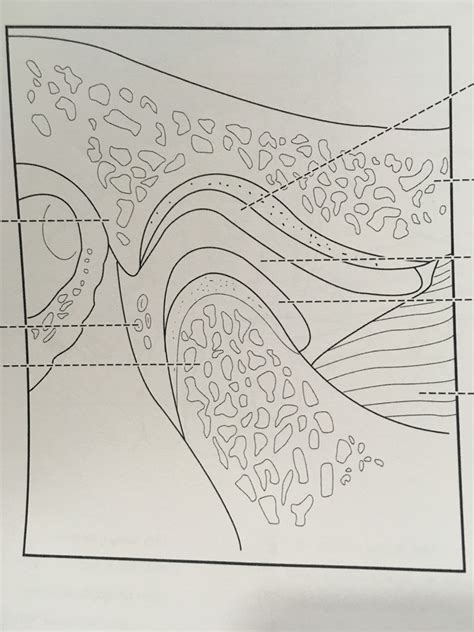 Temporomandibular Joint Sagittal Section With Capsule Removed Diagram