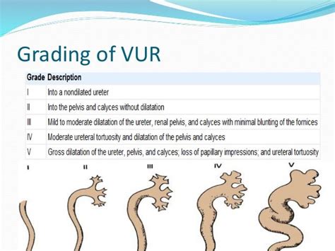 Vesicoureteral Reflux