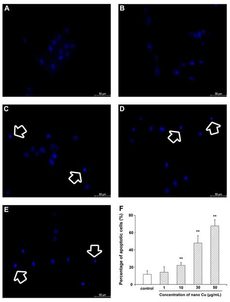 Effect Of Nanosized Copper Particles Nano Cu On Cell Morphological