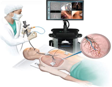 Bronchoscopy Training Course 2024 - Reggi Charisse