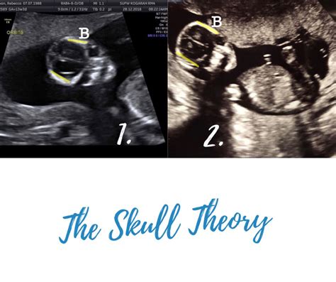 Skull Theory The Physical Attributes Of Your Baby S Skull Matter