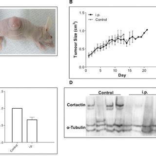 Cbf Inhibited Cortactin Synthesis In Xenografts A A Nude Mouse Model