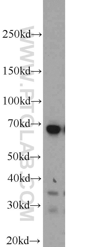 Yy1 Fusion Protein Ag17792 Proteintech