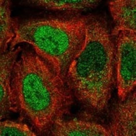 PER2 Antibody Novus Biologicals 100 μg Unconjugated Antibodies