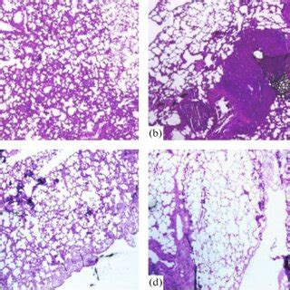 Histopathological Findings H E In Lung Tissue A Control