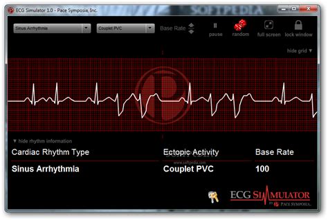 Ecg Simulator Software Electropotent’s Blog