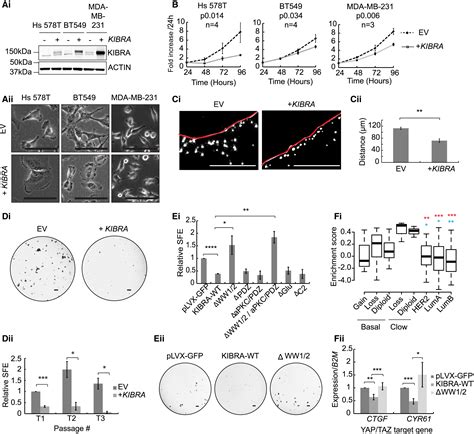 Kibra Wwc Is A Metastasis Suppressor Gene Affected By Chromosome Q