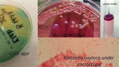 Klebsiella oxytoca: Properties and Pathogenesis – Microbe Online