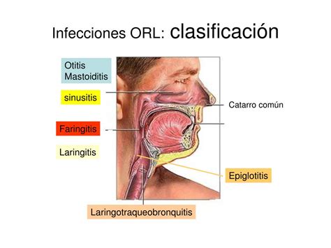 Ppt Tema Diagn Stico Microbiol Gico De Powerpoint Presentation