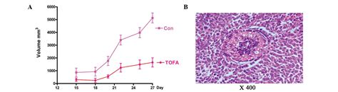 Tofa Suppresses Ovarian Cancer Cell Growth In Vitro And In Vivo