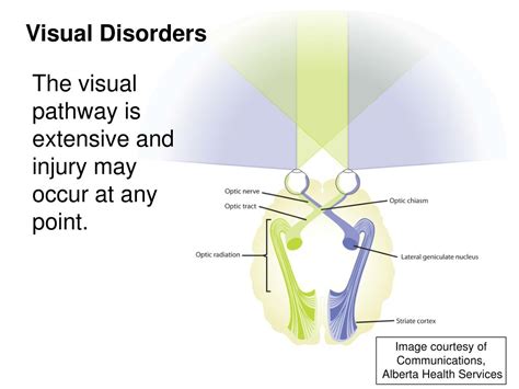 Ppt Practical Considerations Visual Perceptual Disorders Powerpoint Presentation Id 267544