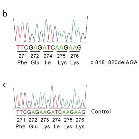 3D-model of normal and mutant GNAT1 interacting with GTPγS. (A ... 
