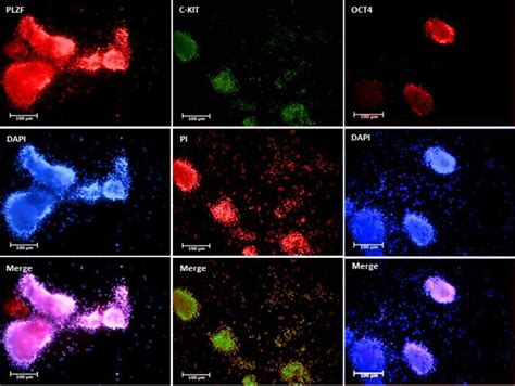 Identification Of Isolated Sscs Was Confirmed By Immunofluorescence