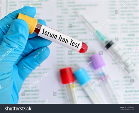 Blood Sample For Serum Iron Test Stock Photo Shutterstock