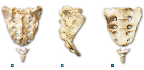 Ap 1 Lab 4 Sacrum And Coccyx Diagram Quizlet