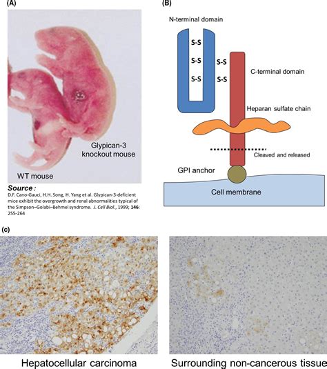 Cancer Immunotherapy‐targeted Glypican‐3 Or Neoantigens Shimizu 2018 Cancer Science