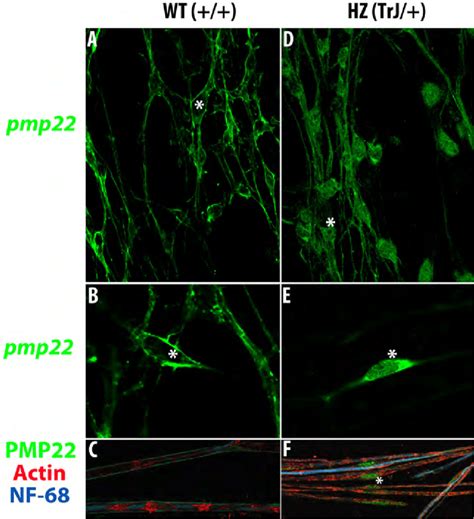 Peripheral Pmp22 Expression The Expression Of Peripheral Myelin