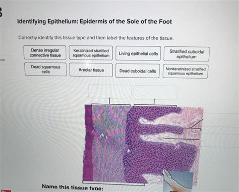 Solved Identifying Epithelium Epidermis Of The Sole Of Chegg